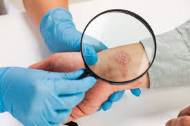 Best Dermatologist and Sexual Disease Specialists in Khulna - Doctor Khulna